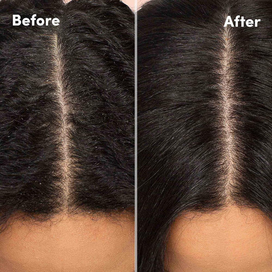 MIZANI Scalp Care Dandruff Shampoo